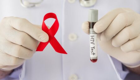Одесситам предлагают бесплатное тестирование на ВИЧ