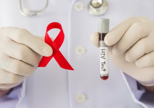Одесситам предлагают бесплатное тестирование на ВИЧ
