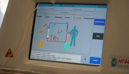 Одеська обласна дитяча лікарня отримала апарат гемофільтрації