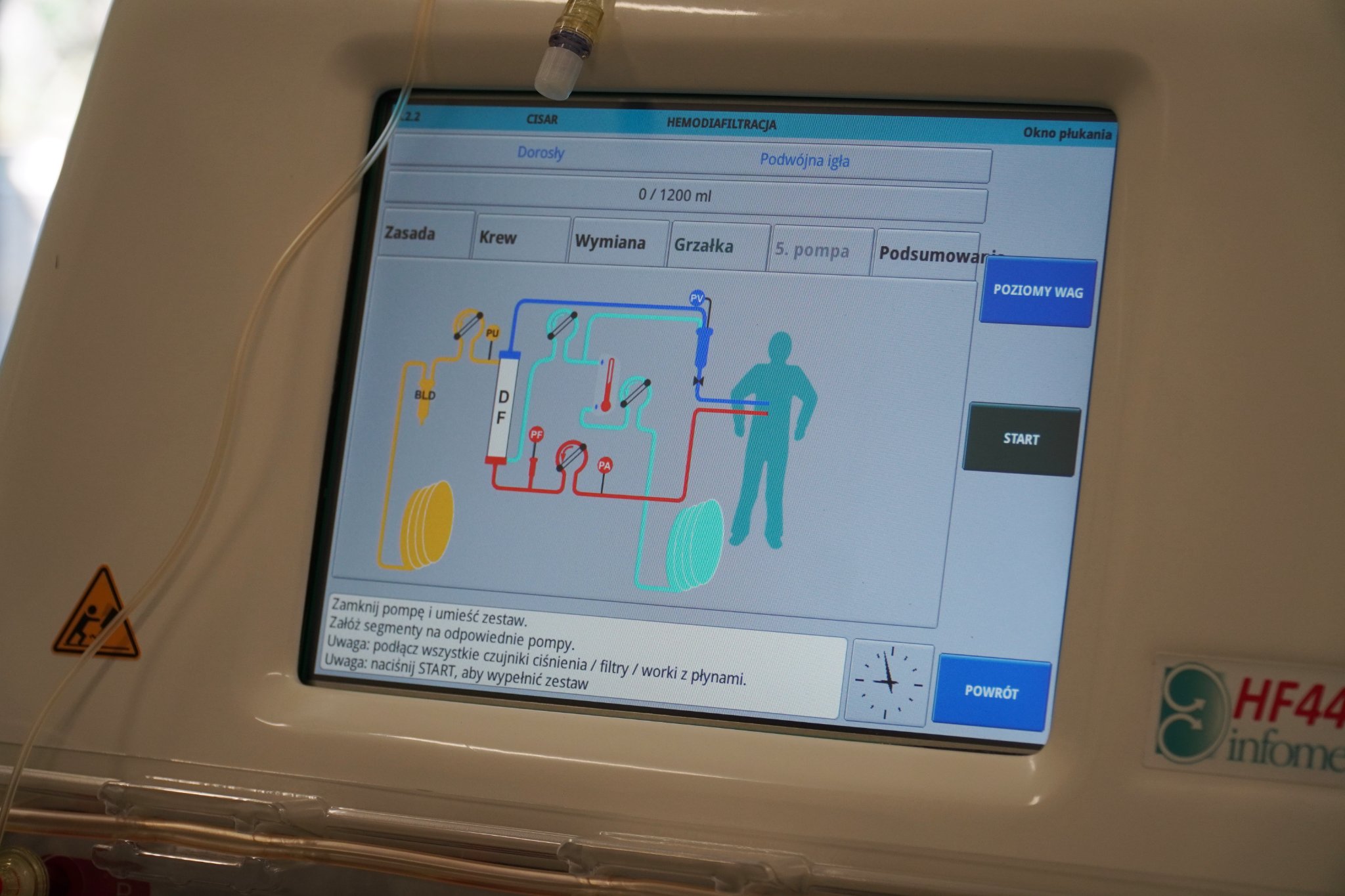 Одеська обласна дитяча лікарня отримала апарат гемофільтрації