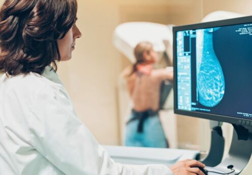 В Одесі можна безкоштовно пройти мамографію