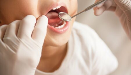 деситів запрошують безоплатно перевірити здоров’я зубів дітей