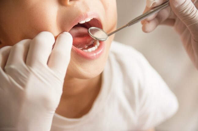 деситів запрошують безоплатно перевірити здоров’я зубів дітей